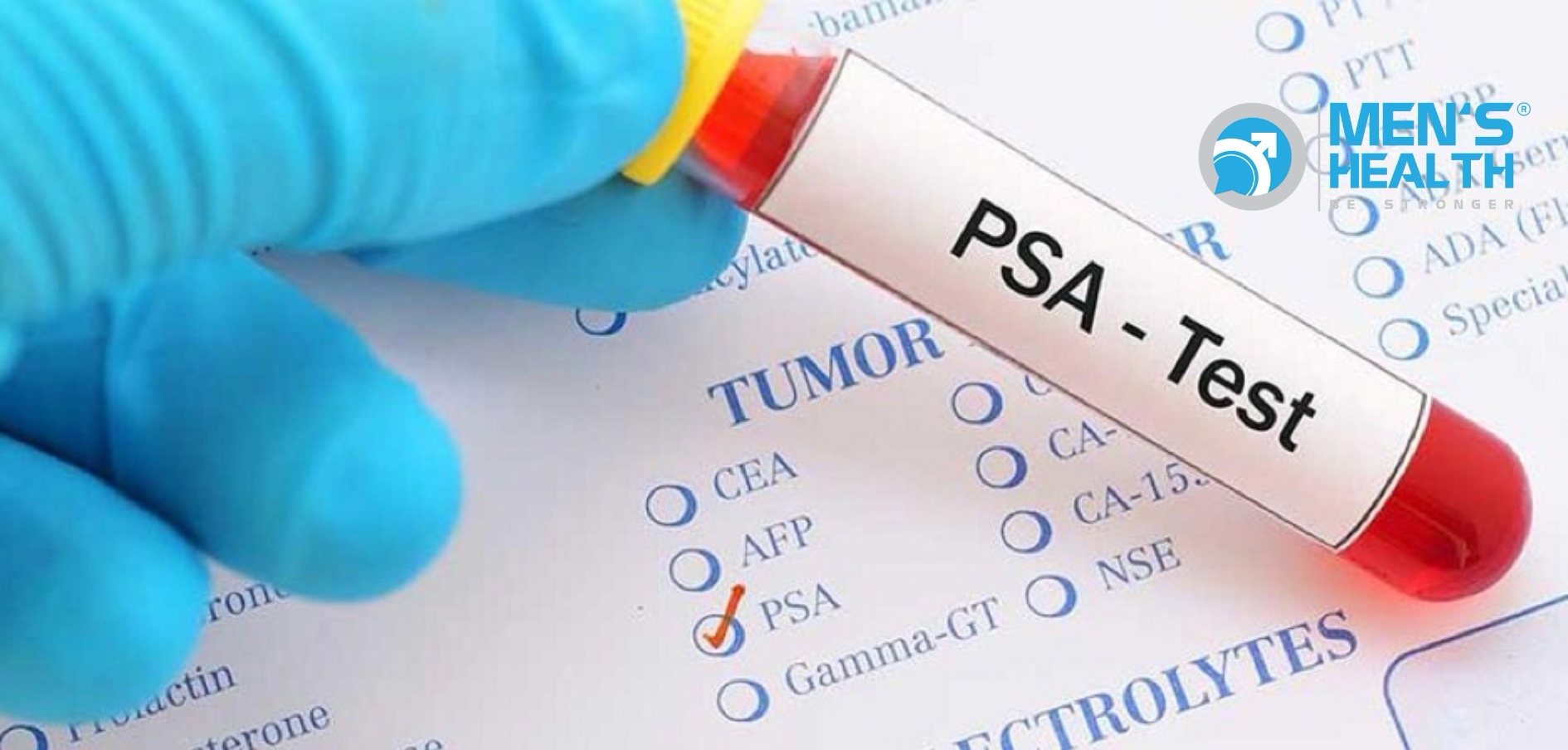 Xét nghiệm kháng nguyên đặc hiệu tuyến tiền liệt (PSA) mang ý nghĩa gì?