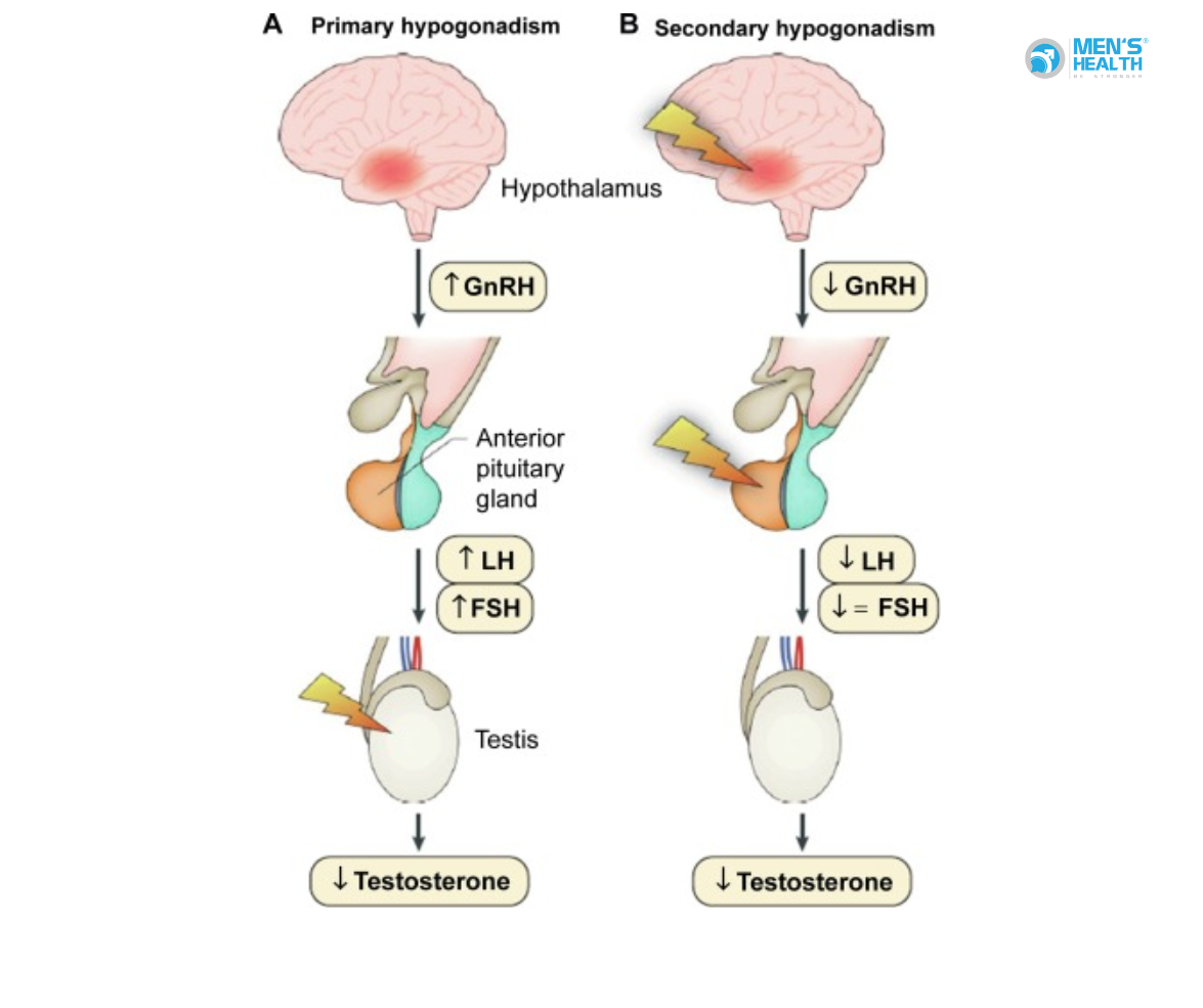 Suy Sinh Dục Do Giảm Gonadotropin Và Vai Trò Trong Vô Tinh Không Tắc Nghẽn