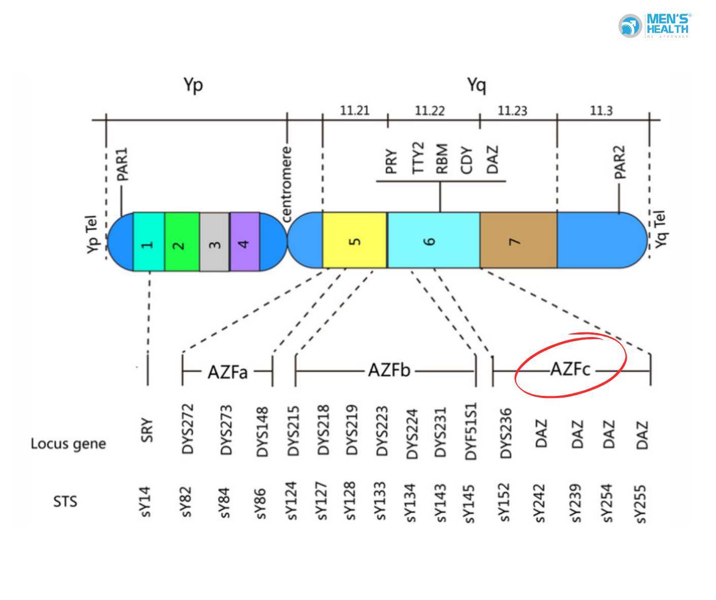 Vi Mất Đoạn AZFc (AZFc Microdeletion)