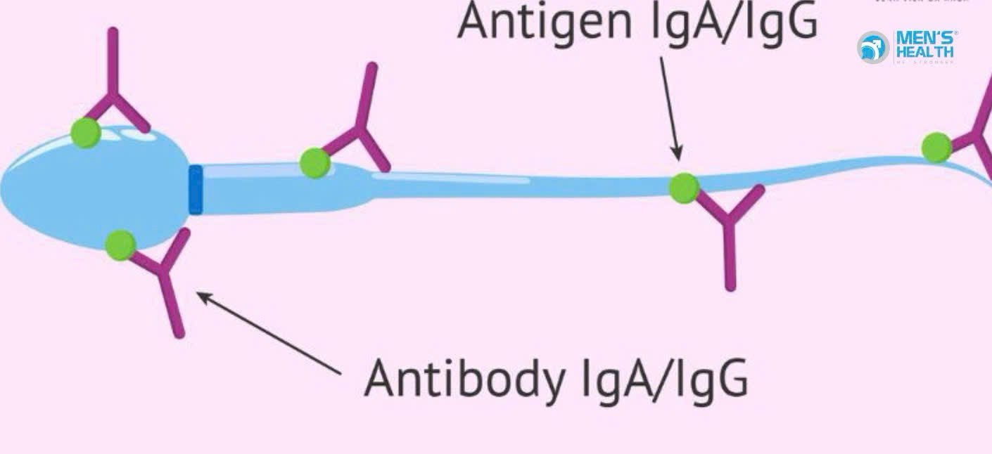 Kháng Thể Kháng Tinh Trùng: Cơ Chế, Tác Động, Và Điều Trị