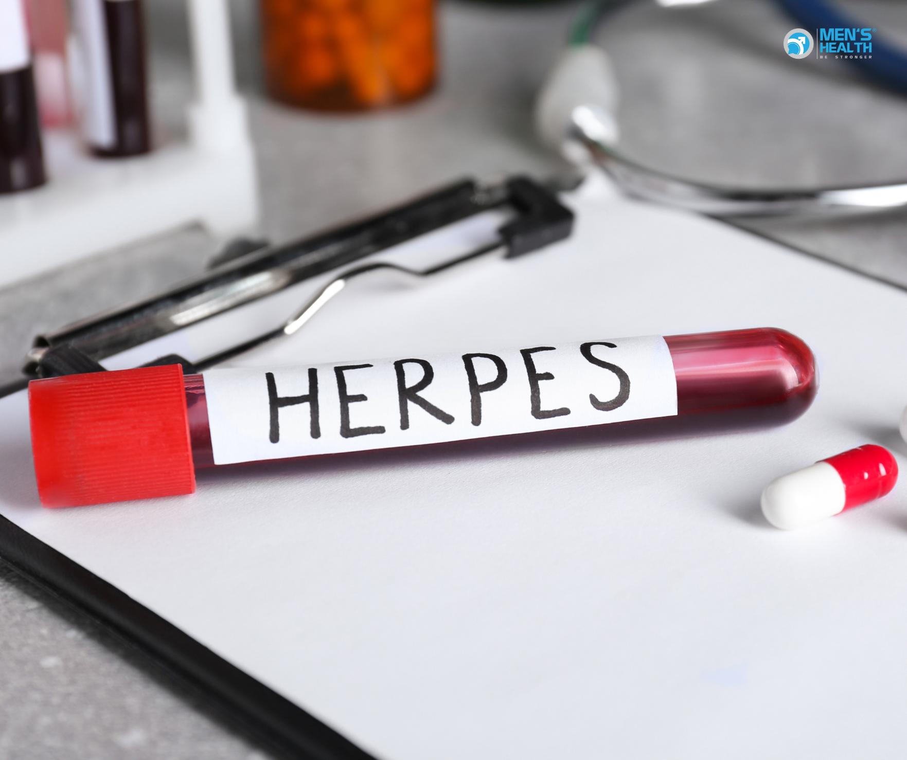 Nhiễm Herpes Simplex Virus (HSV) Ở Nam Giới: Hiểu Rõ Để Phòng Tránh Và Điều Trị Hiệu Quả