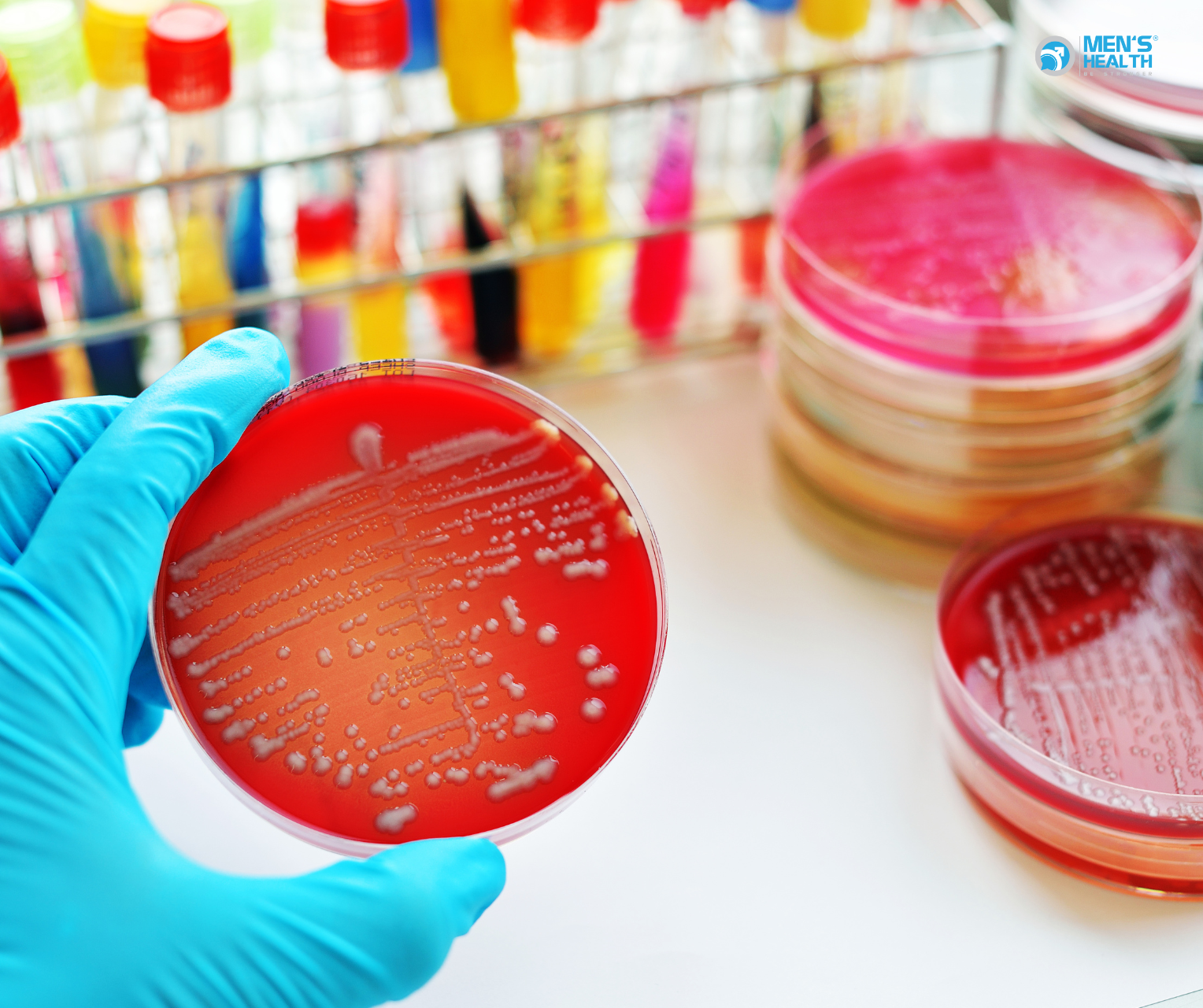 Nhiễm Lậu Cầu Khác (Other Gonococcal Infections – A54.8)