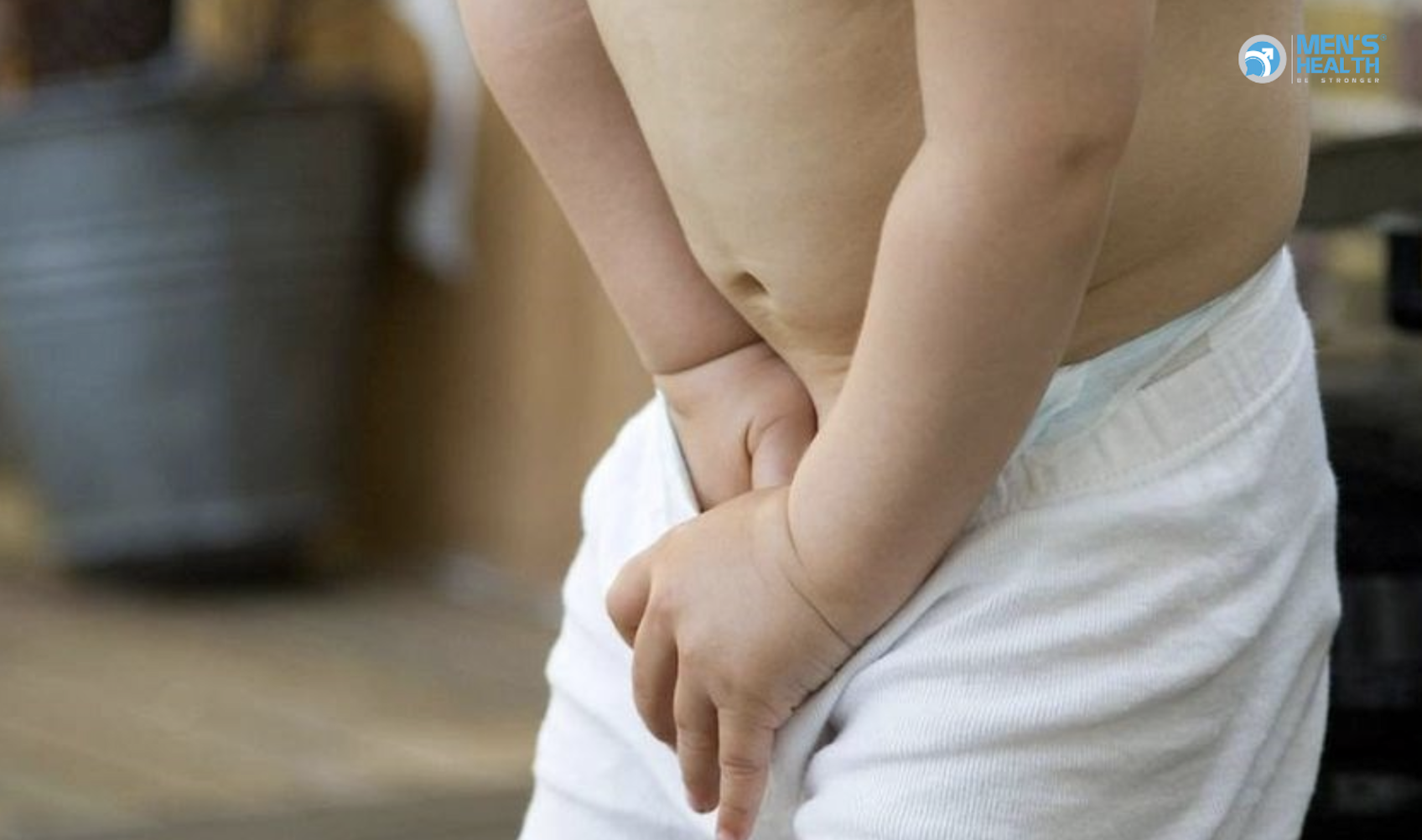 Hội Chứng Dương Vật Mùa Hè (Summer Penile Syndrome)