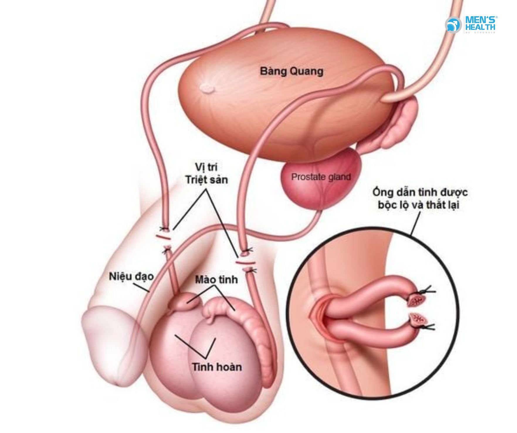 Thắt Ống Dẫn Tinh Nam Giới Có Xuất Tinh Và Đạt Khoái Cảm Bình Thường?