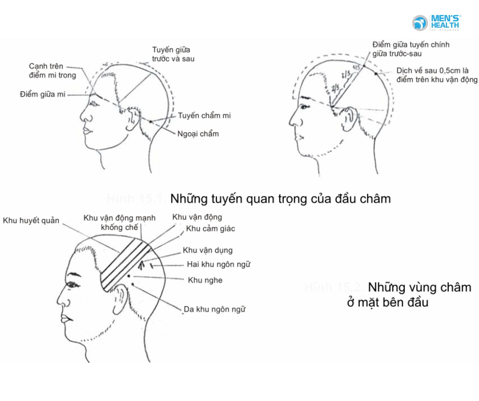 Đầu Châm Trong Y Học Cổ Truyền: Điểm Giao Thoa Giữa Thần Kinh Học Và Khí Năng