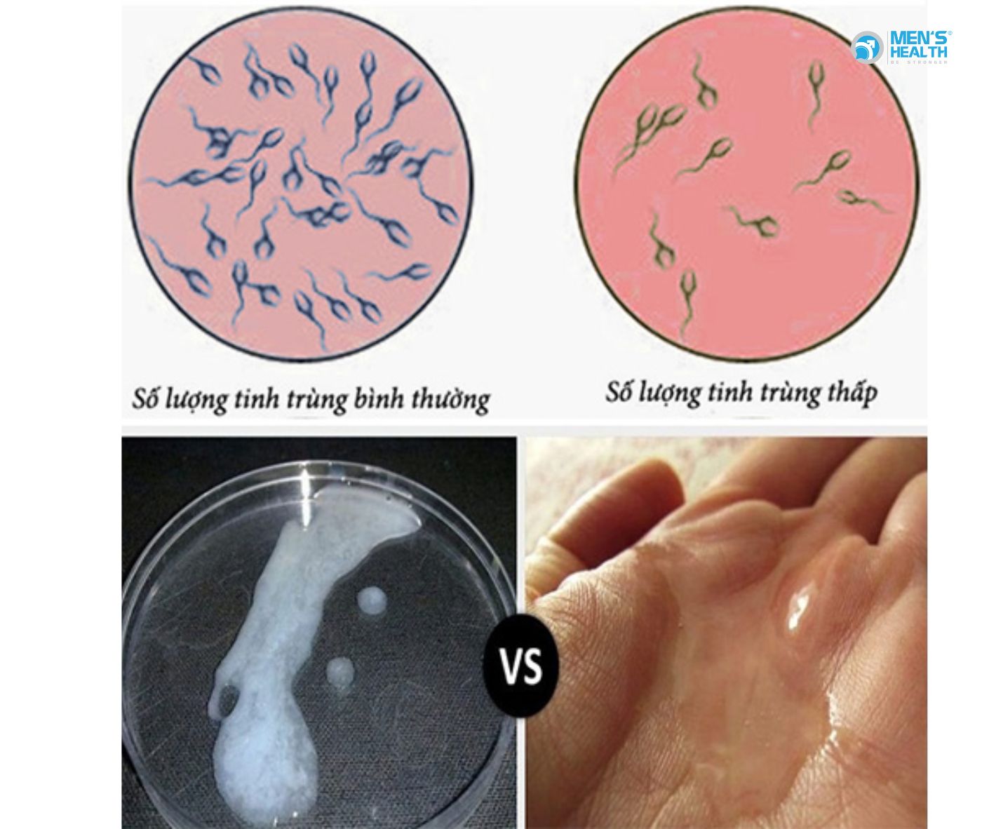 Tình Trạng Suy Giảm “Tinh Binh” Ở Nam Giới: Vấn Nạn Thời Đại Hiện Đại