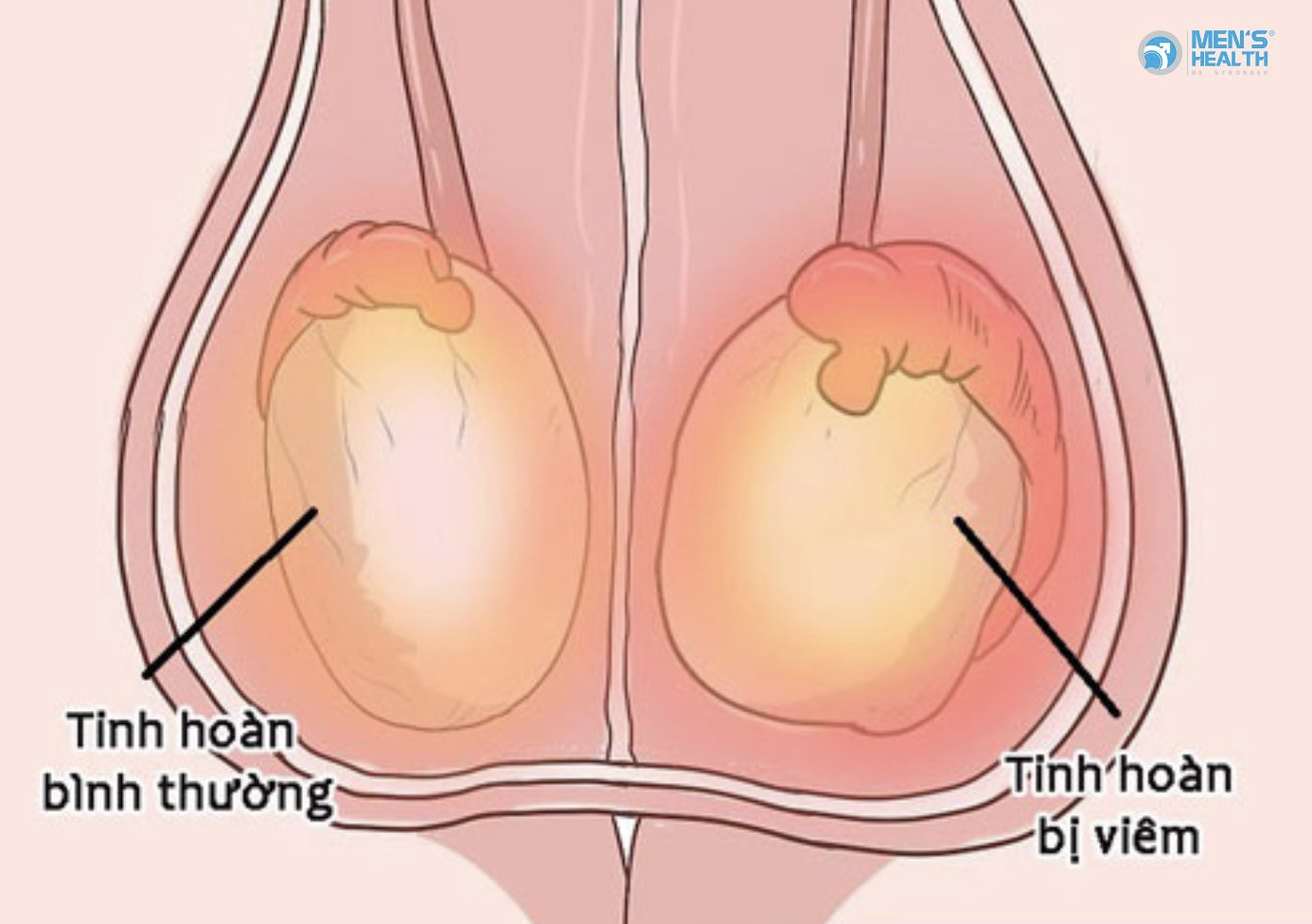Đau Tinh Hoàn Sau Khi Quan Hệ Tình Dục