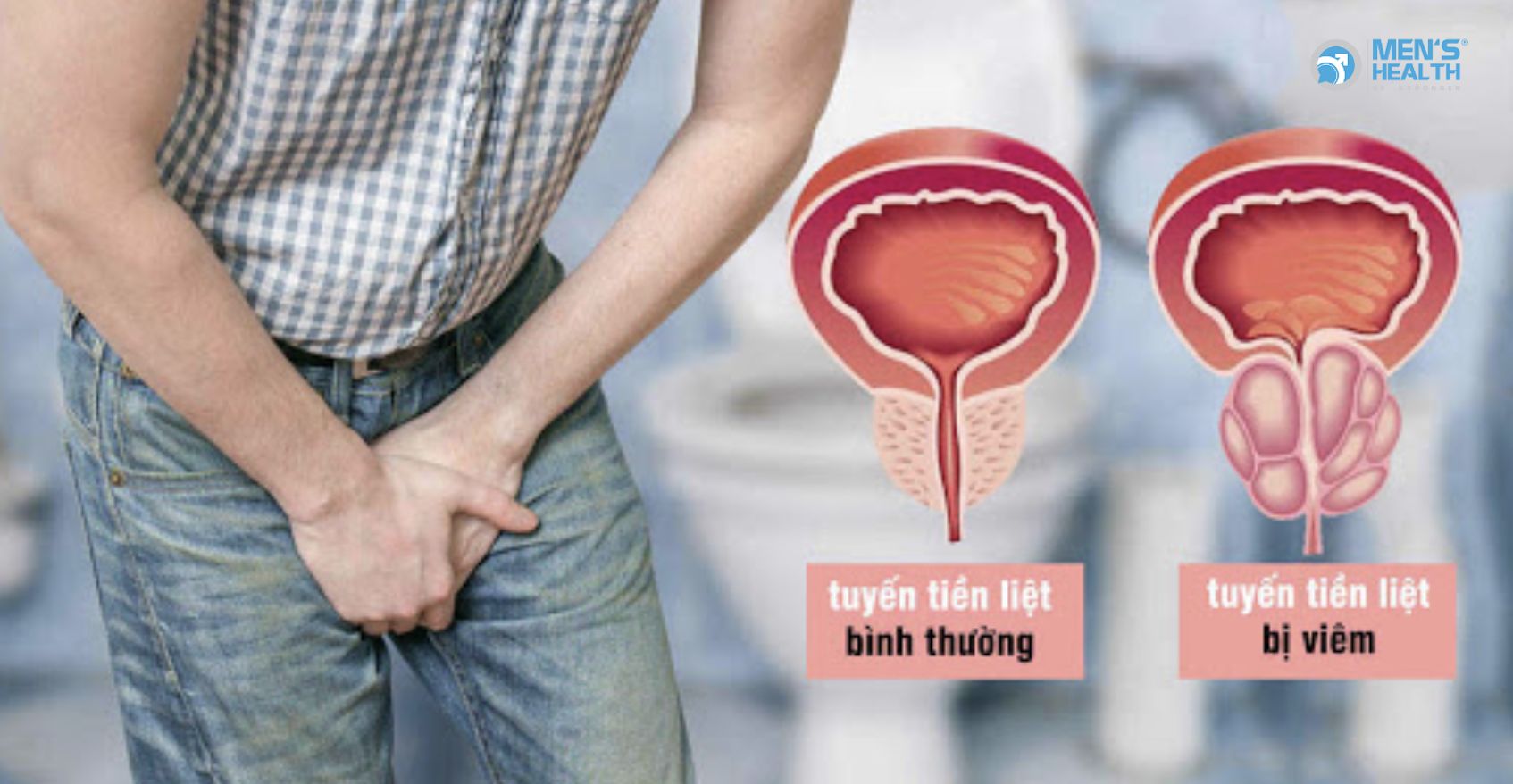 Sai Lầm Phổ Biến Khiến Nhiều Nam Giới Mắc Bệnh Tuyến Tiền Liệt