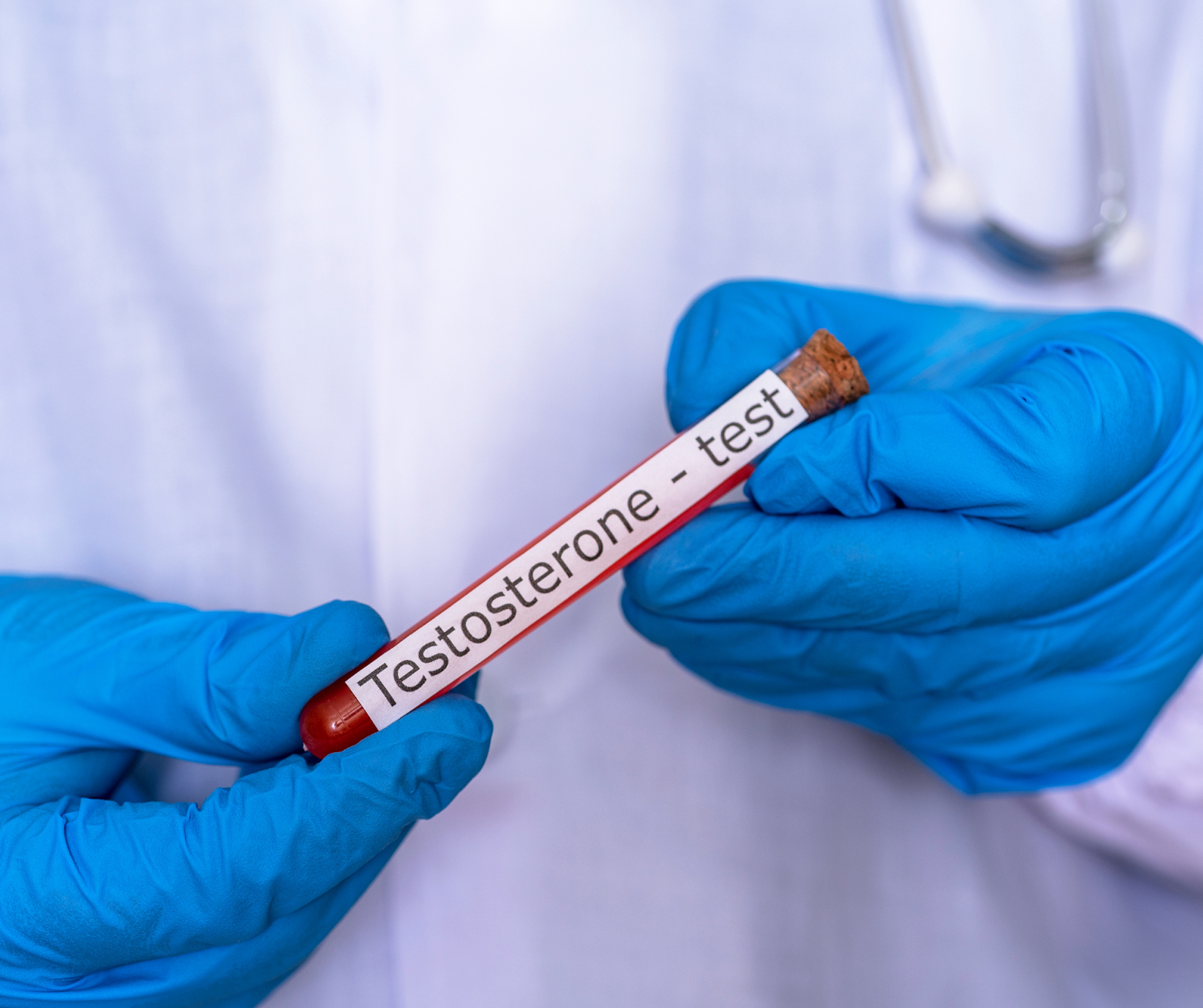 Công Dụng Thường Gặp Và Tác Dụng Phụ Cần Cảnh Giác Khi Sử Dụng Testosterone