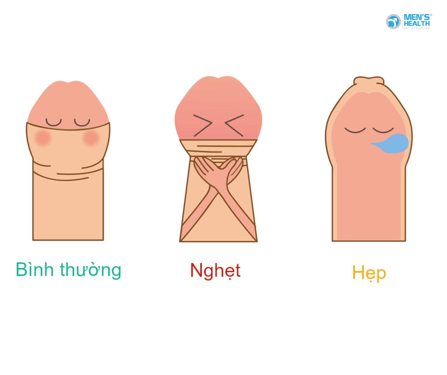 Hiểm Họa Từ Việc Tự Nong, Kéo Hoặc Dùng Thuốc Bôi Lên Bao Quy Đầu Không Rõ Nguồn Gốc Tại Nhà