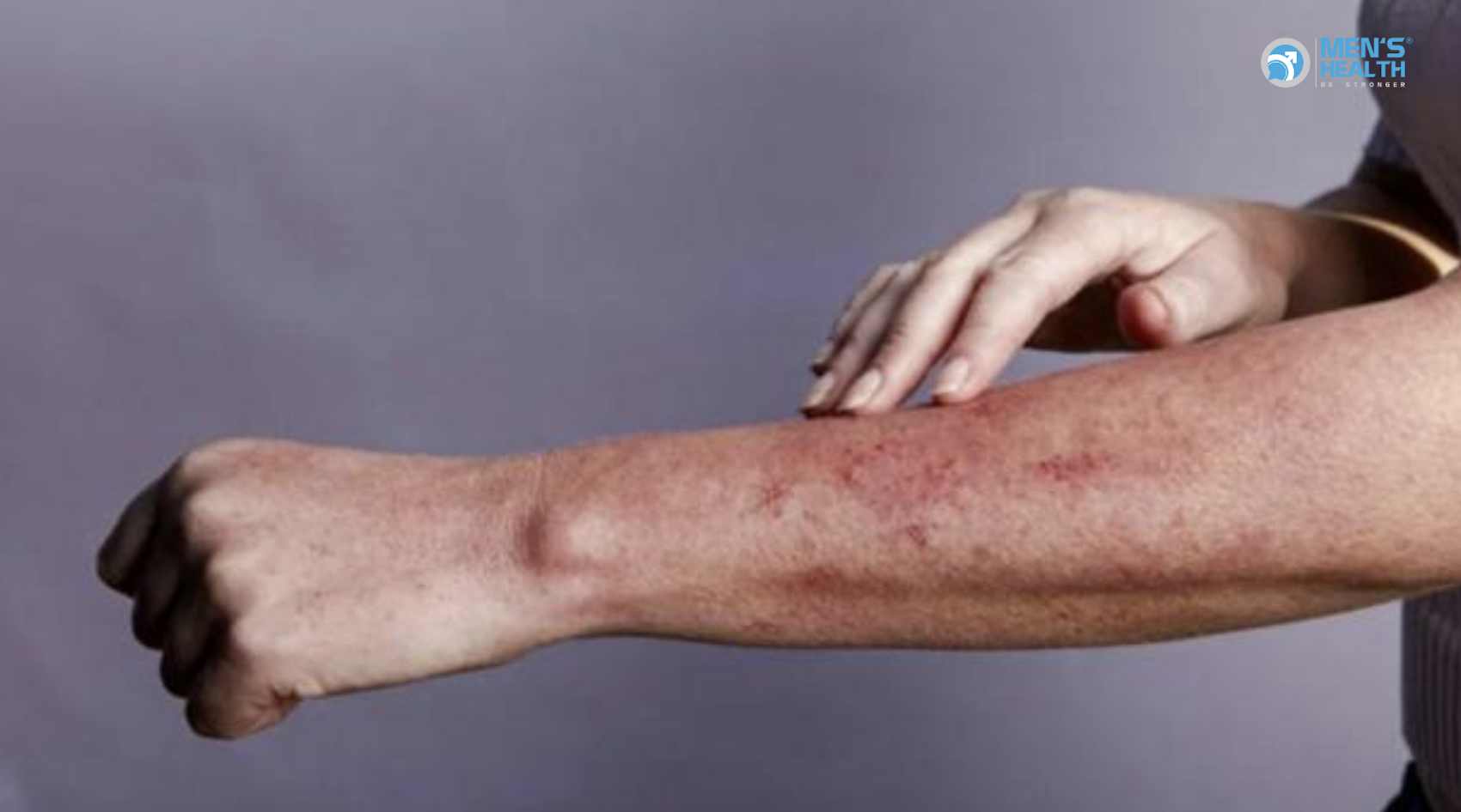 Lão Hóa Sớm Ở Người Nhiễm HIV